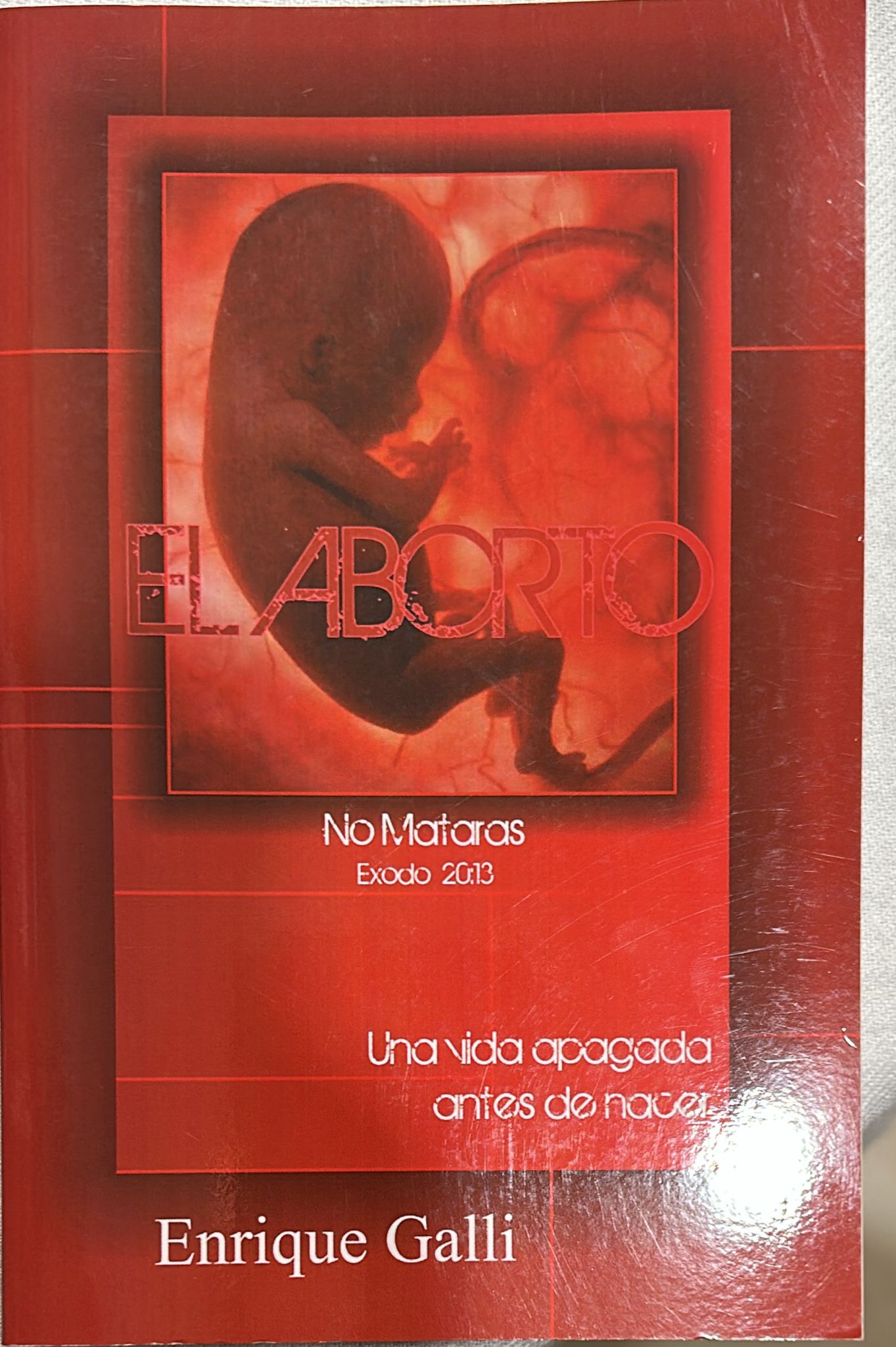 EL ABORTO - NO MATARAS